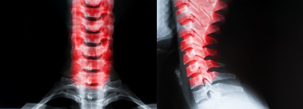 spinal-cord